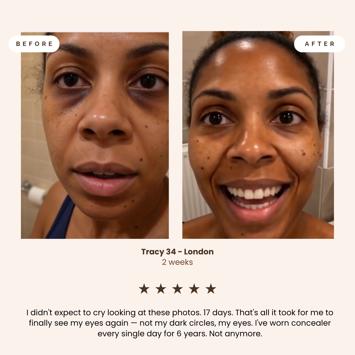 Loryaa RADIANCE Eye Wand