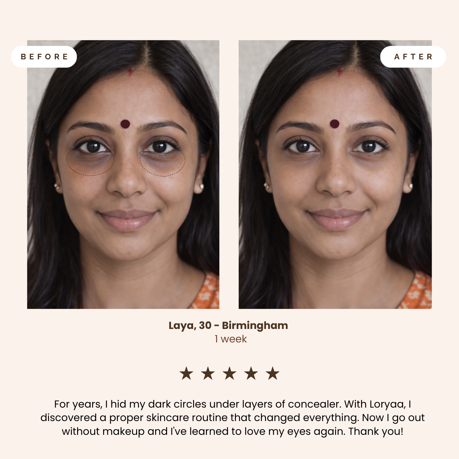 Loryaa RADIANCE Eye Wand